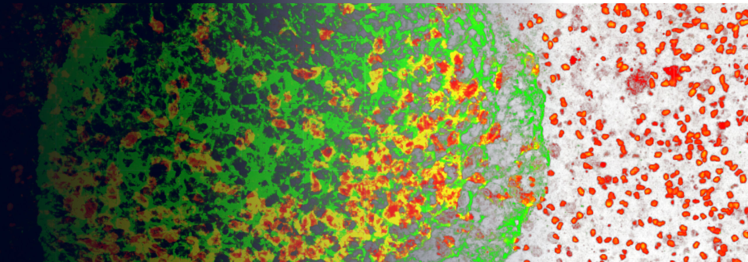 Eine mikroskopische Aufnahme als Hintergrundbild zur Ankündigung des Vortrages von Prof. Hansmann